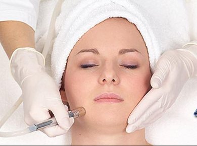 Microdermabarasion